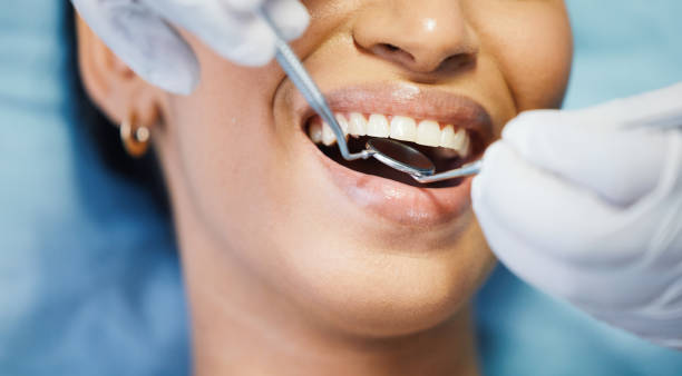 Best Dentist for Tooth Abscess  in Palm City, FL